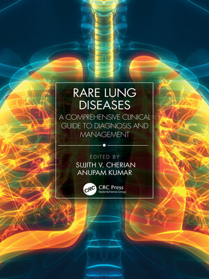 cover image of Rare Lung Diseases